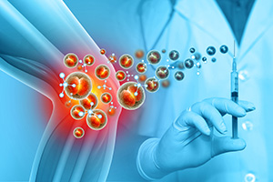 TB-500 Peptide Therapy in Delphi, IN